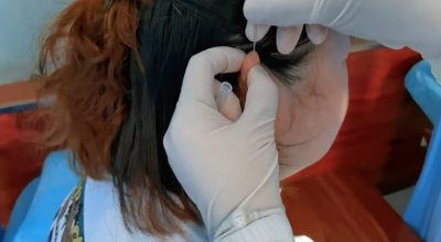 Trattamento con agopuntura di pazienti affetti da paresi facciali, videoconferenza tra Aou Senese e Nantong Hospital